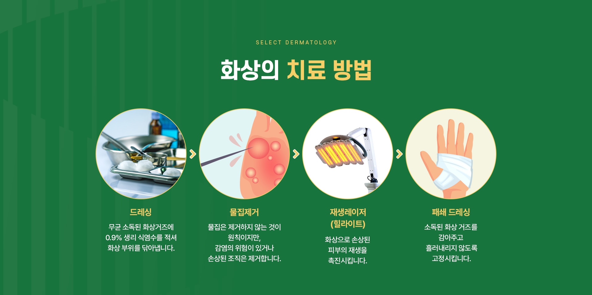 화상 주의