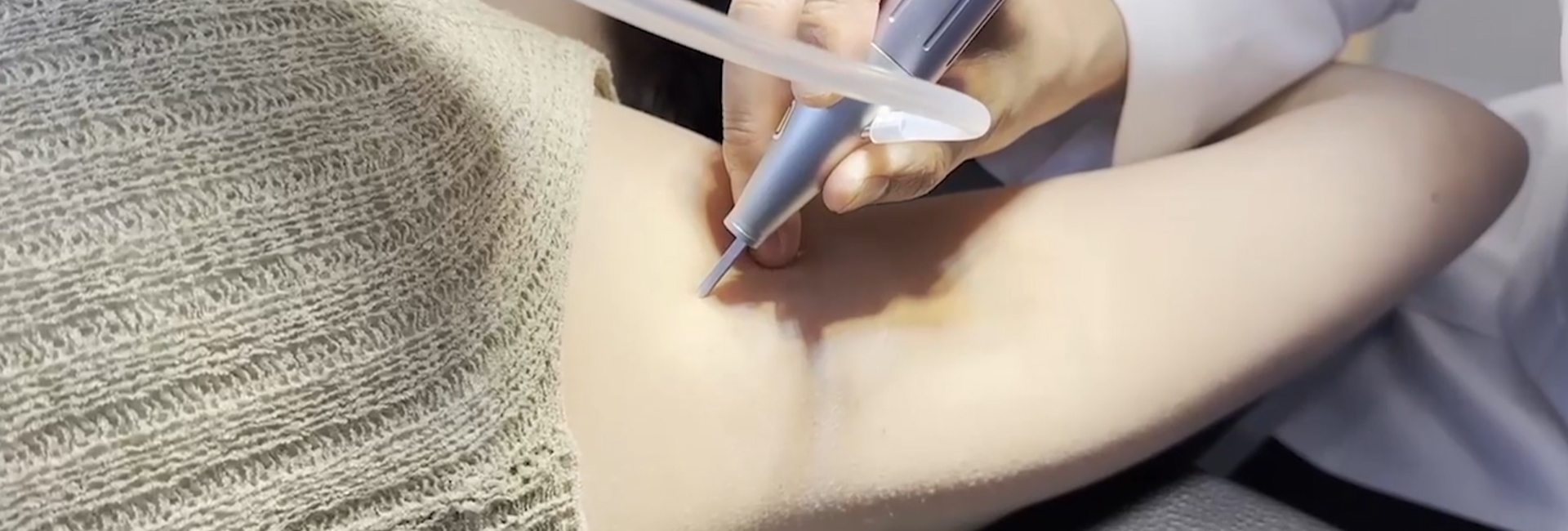섬유종/쥐젖 키비주얼