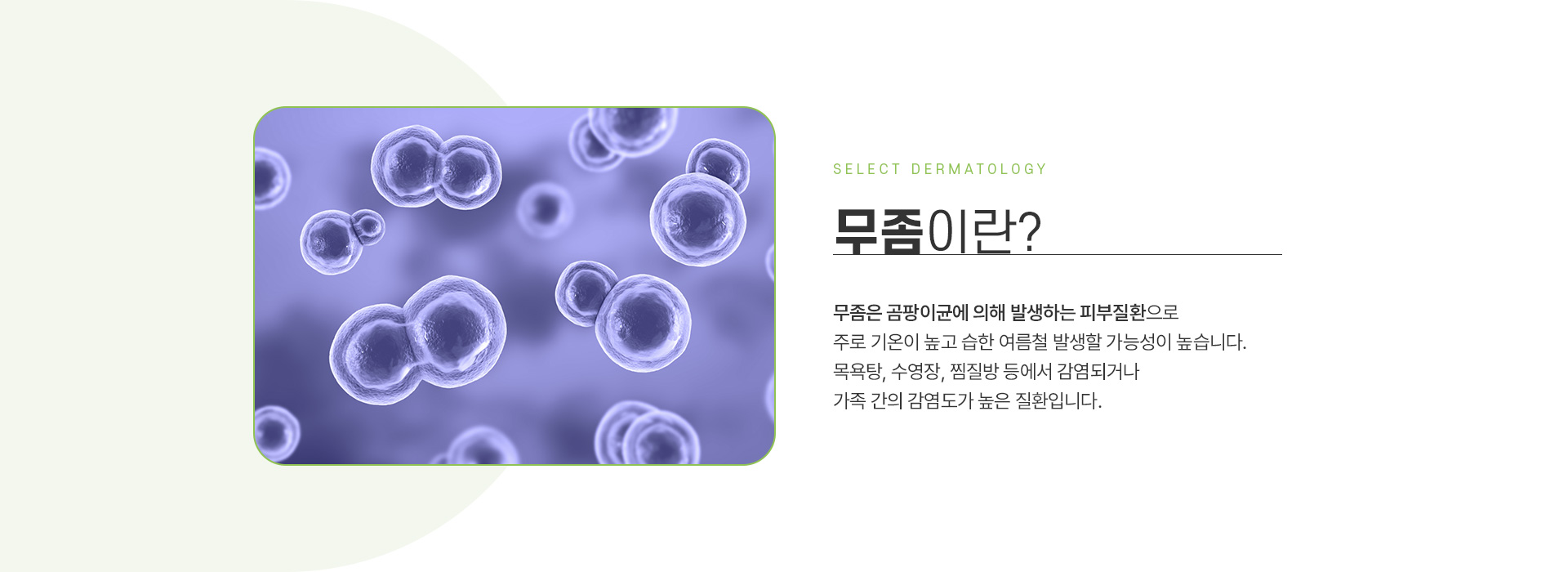 무좀 주의